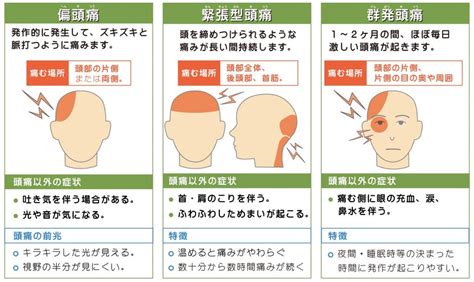 頭痛 位置|頭痛の種類まとめ～それぞれの違いと原因、症状、治。